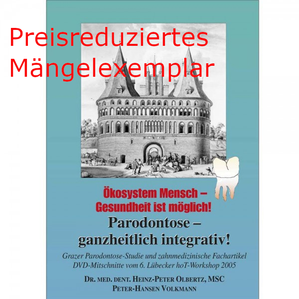 Parodontose – ganzheitlich integrativ! Mängelexemplar Parodontose – ganzheitlich integrativ! Mängelexemplar